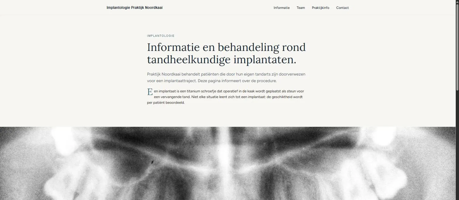 Voorbeeld van de website voor Implantologie Praktijk Noordkaai